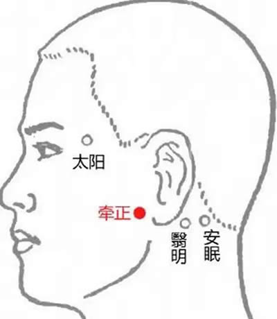 牵正穴的正确位置图