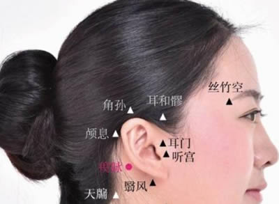 瘈脉穴的正确位置图