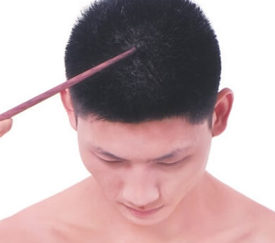 前顶穴的正确位置图