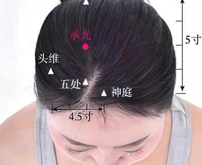 承光穴的正确位置图