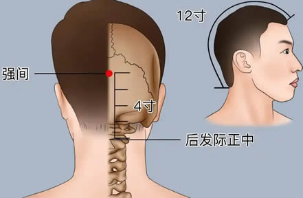 强间穴的正确位置图