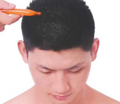 承灵穴的正确位置图