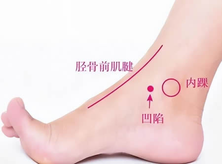 内踝尖穴的正确位置图